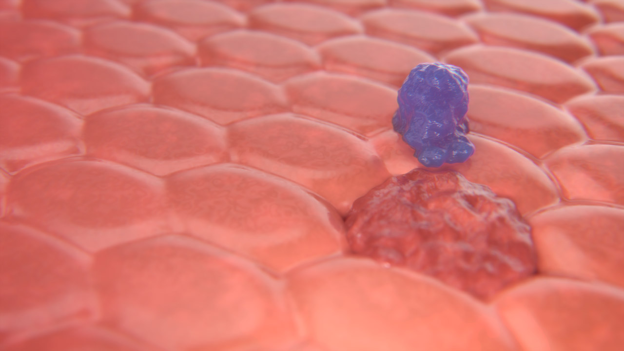 CAR-T Cell Left Still 1