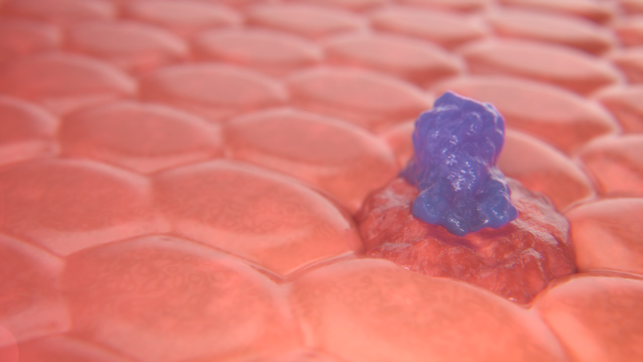 CAR-T Cell Left Still 2