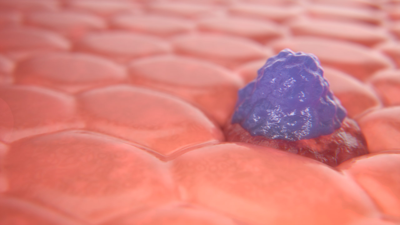 CAR-T Cell Left Still 3