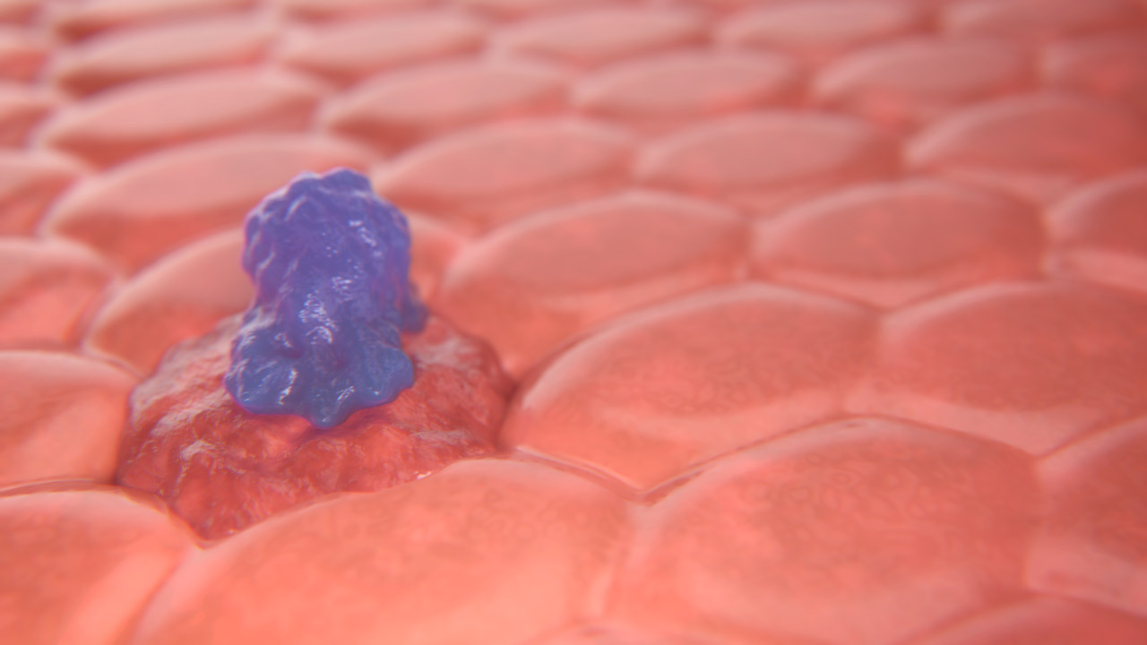 CAR-T Cell Attacking a Cancer Cell — Left