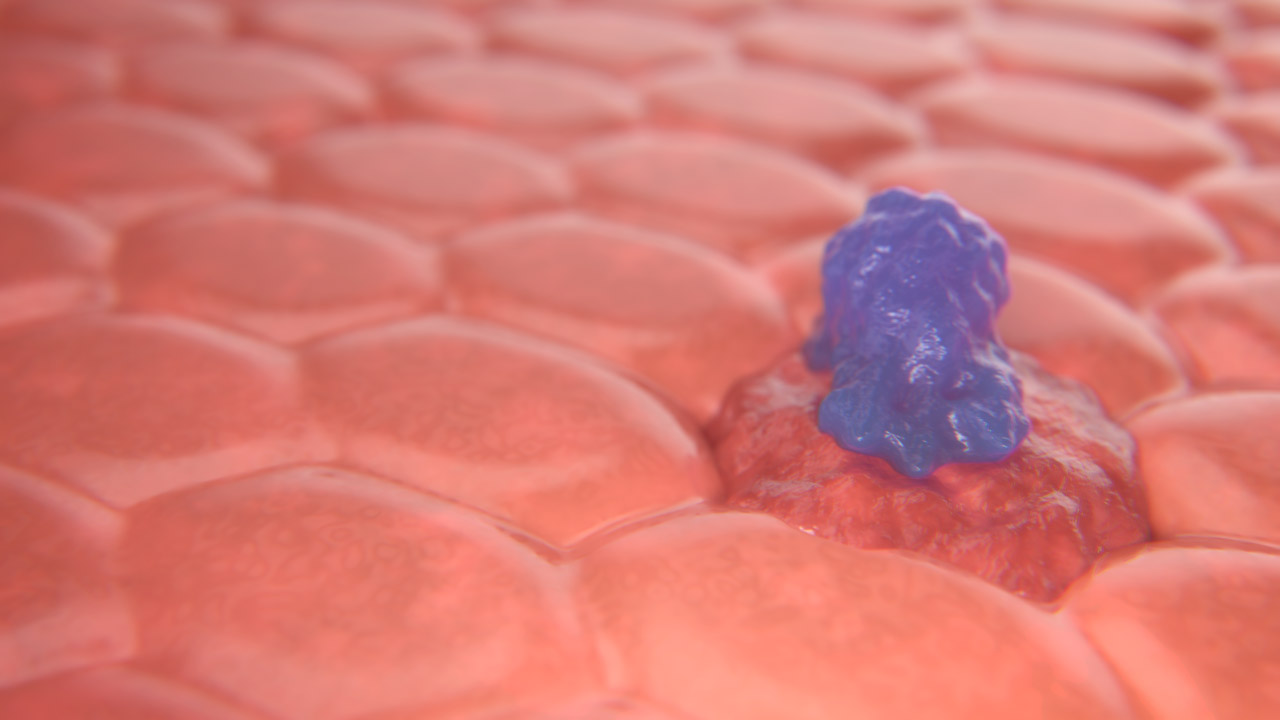 CAR-T Cell Attacking a Cancer Cell — Right