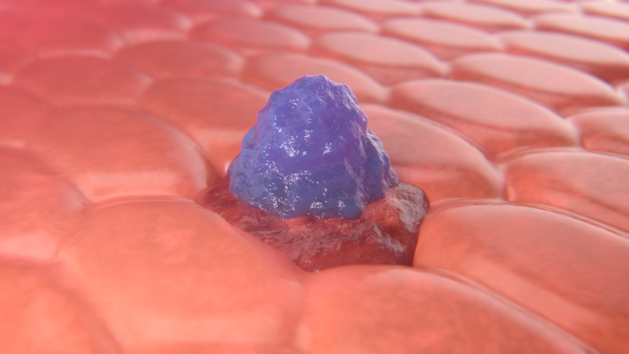CAR-T Cell Center Still 2