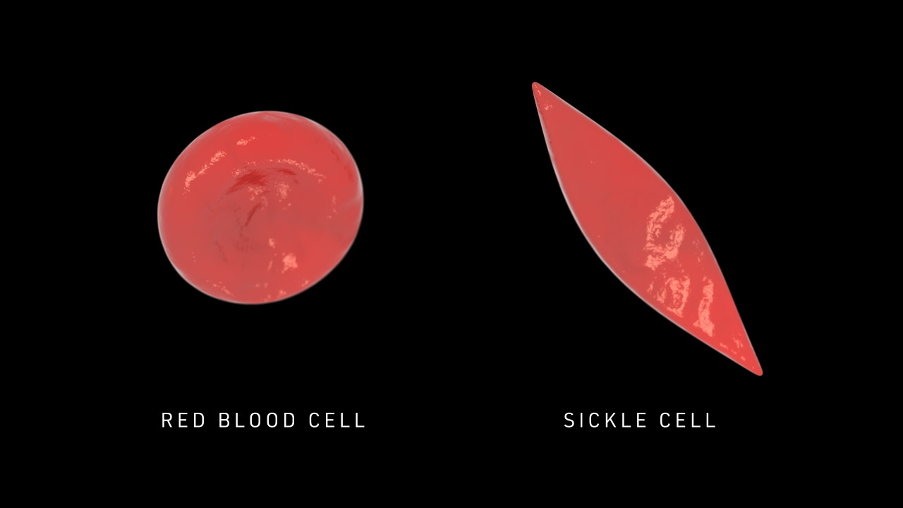 Red Blood Cell vs Sickle Cell Loop Black