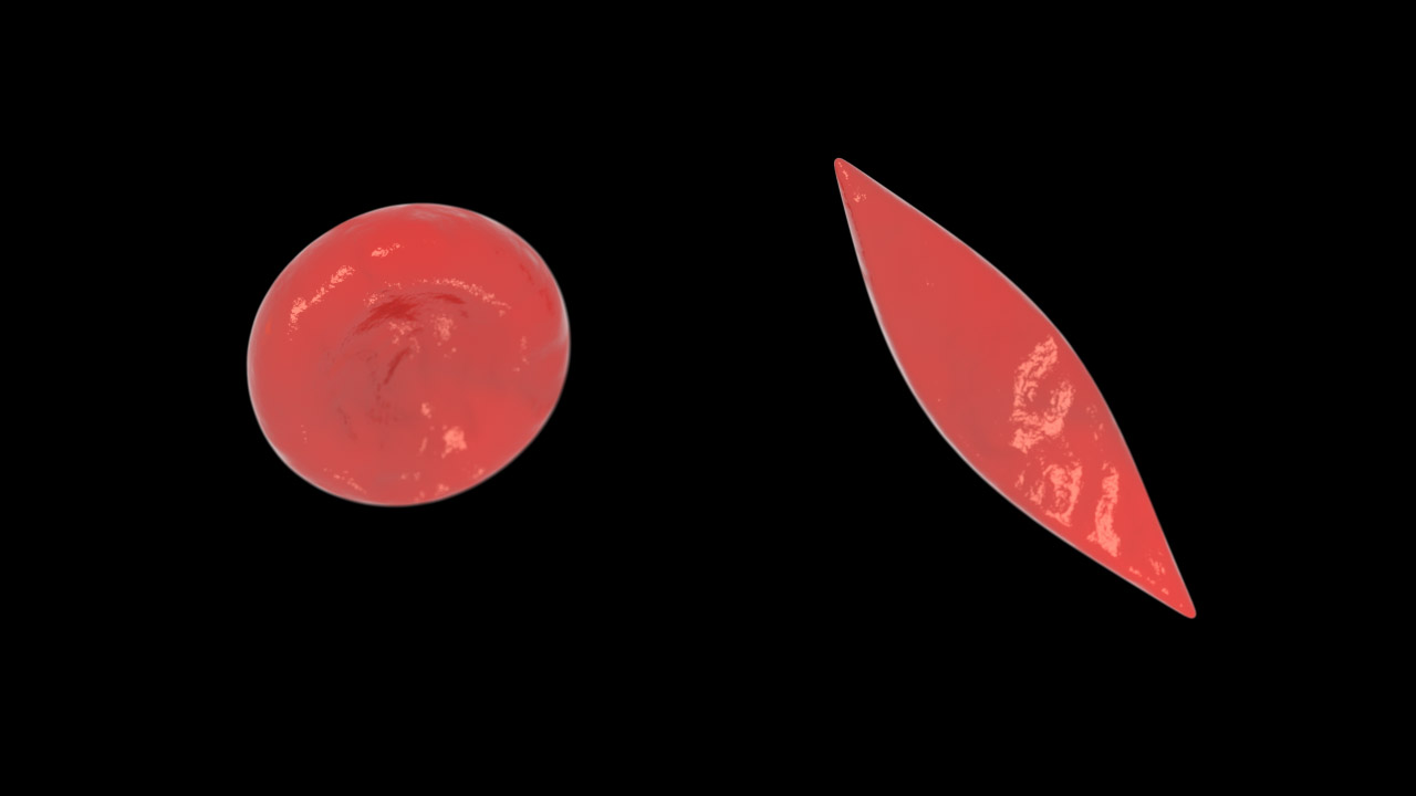 Red Blood Cell vs Sickle Cell No Labels Black