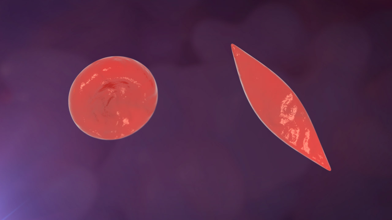 Red Blood Cell vs Sickle Cell No Labels Maroon