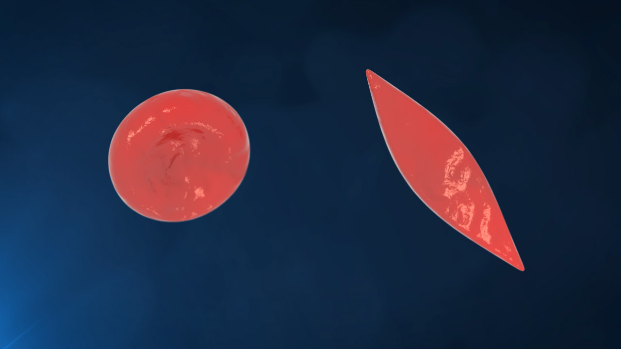 Red Blood Cell vs Sickle Cell No Labels Navy